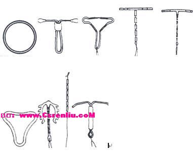 目前国内外常用的节育器为: 1,带铜t型节育器 t型塑料支架